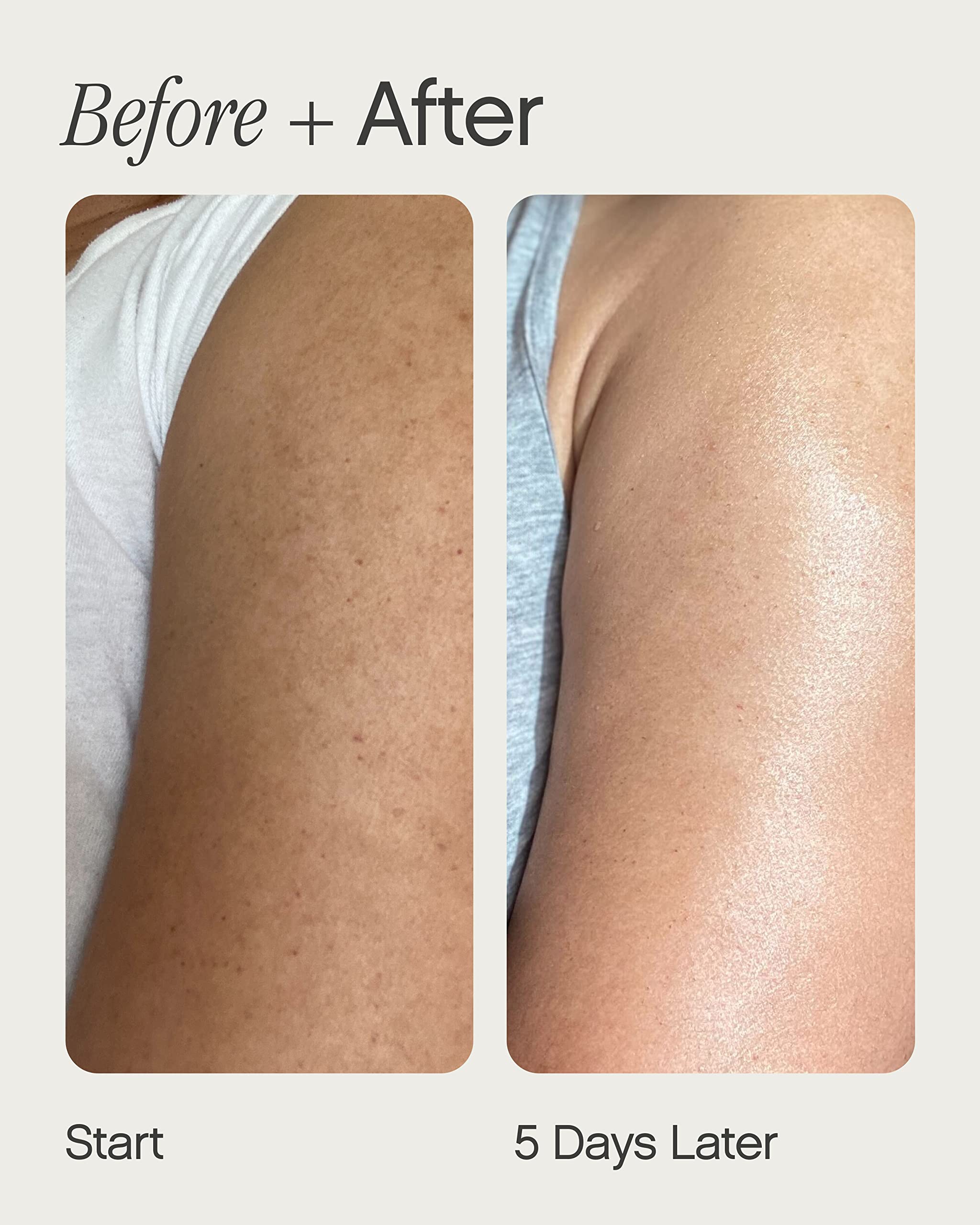 Topicals Slather Exfoliating Body Serum - With Retinol, Squalane, Urea and AHAs for Bumpy, Rough or Textured Skin - AHA Exfoliating Serum for Body (5 Fl Oz)